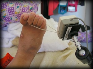 Patty's right foot with string switch